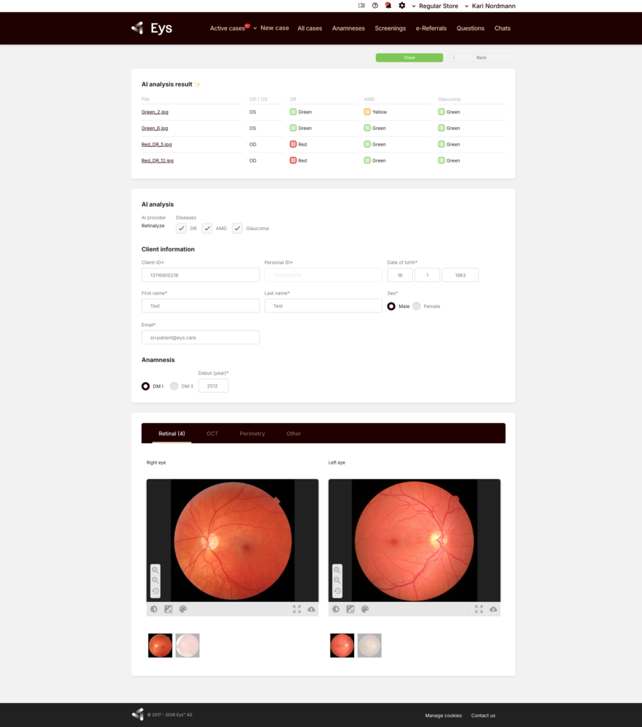 Completed RetinaLyze screening in EYS